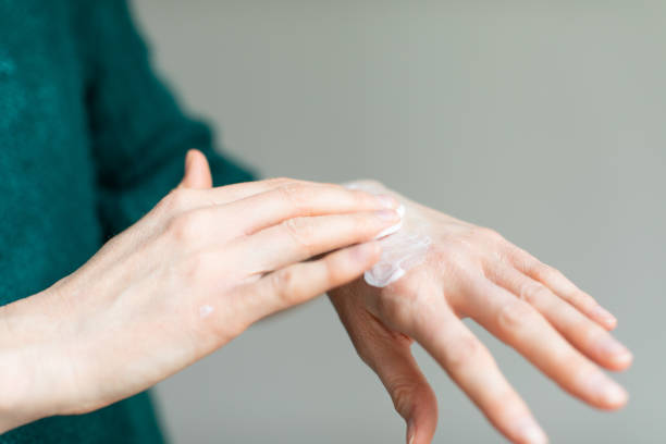 Treatments to recover your hands in winter