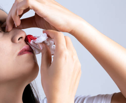 Why is my nose bleeding? | Causes of Nosebleed